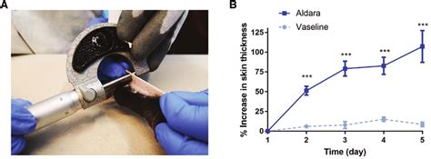 how to measure skin thickness|skin thickness chart.